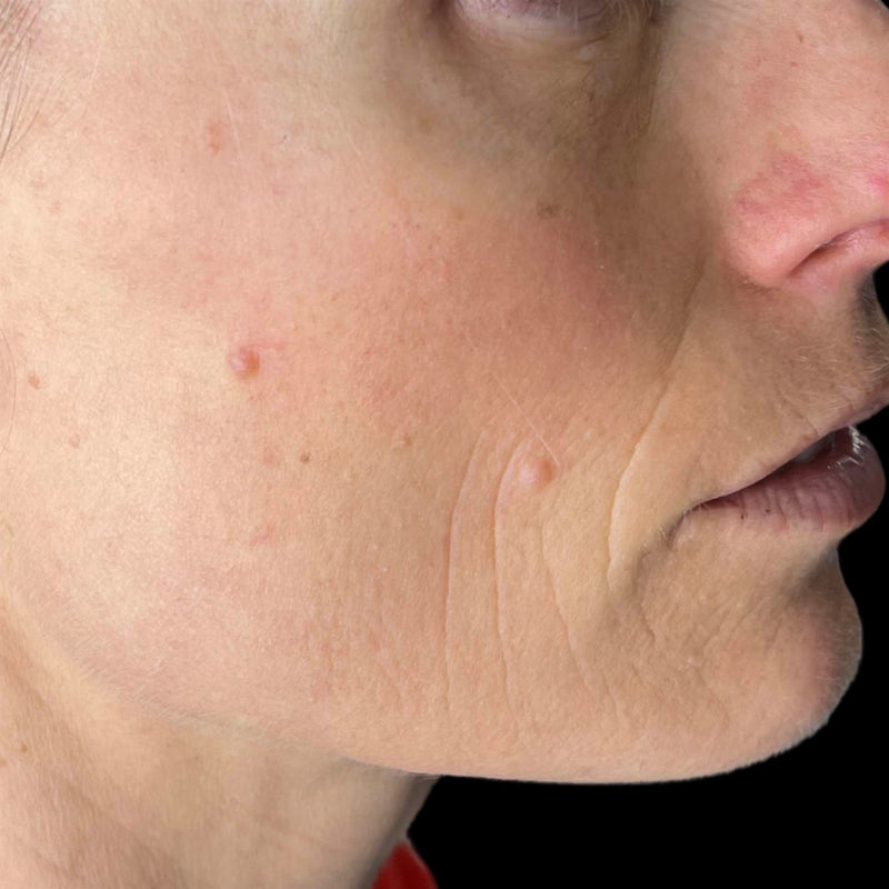 Skin Absense Key Skin Concerns – Lab Creations